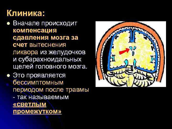 Клиника: l l Вначале происходит компенсация сдавления мозга за счет вытеснения ликвора из желудочков