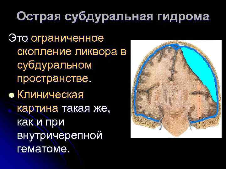 Острая субдуральная гидрома Это ограниченное скопление ликвора в субдуральном пространстве. l Клиническая картина такая