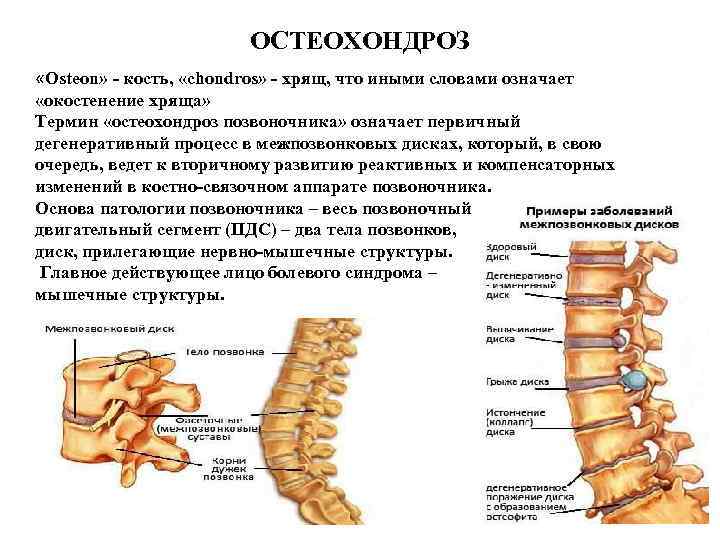 ОСТЕОХОНДРОЗ «Osteon» - кость, «chondros» - хрящ, что иными словами означает «окостенение хряща» Термин