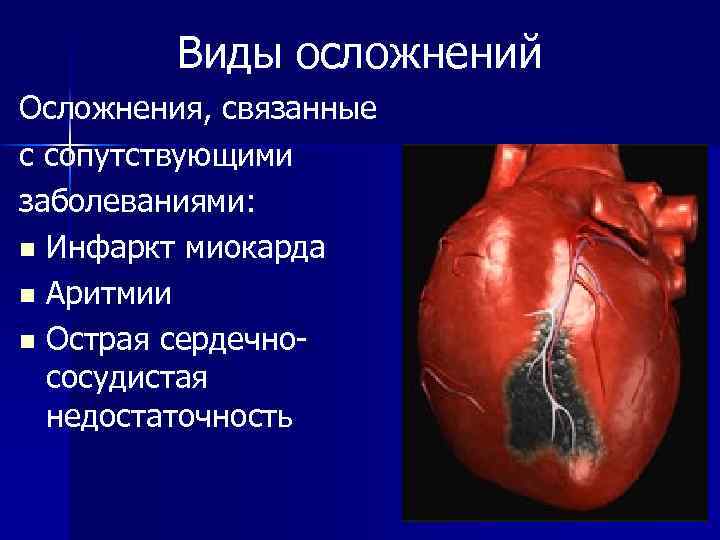 Виды осложнений Осложнения, связанные с сопутствующими заболеваниями: n Инфаркт миокарда n Аритмии n Острая