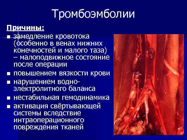 Тромбоэмболии Причины: n замедление кровотока (особенно в венах нижних конечностей и малого таза) –