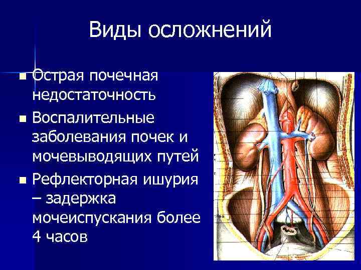 Виды осложнений Острая почечная недостаточность n Воспалительные заболевания почек и мочевыводящих путей n Рефлекторная