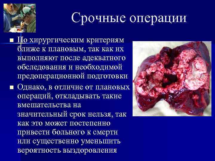   Срочные операции n  По хирургическим критериям ближе к плановым, так