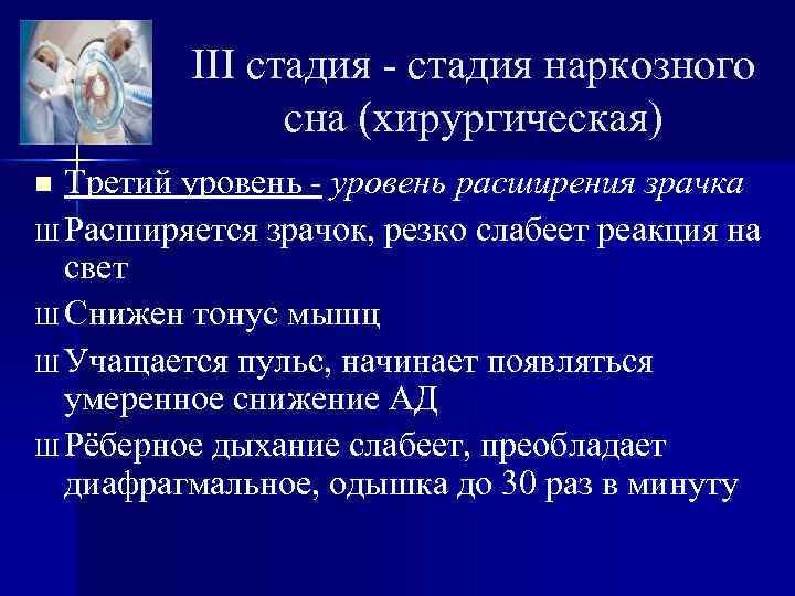 III стадия - стадия наркозного сна (хирургическая) Третий уровень - уровень расширения зрачка Ш