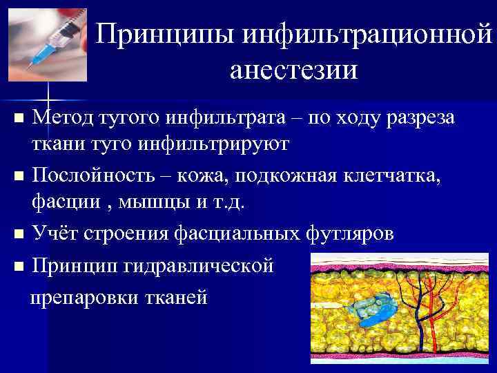 Принципы инфильтрационной анестезии Метод тугого инфильтрата – по ходу разреза ткани туго инфильтрируют n