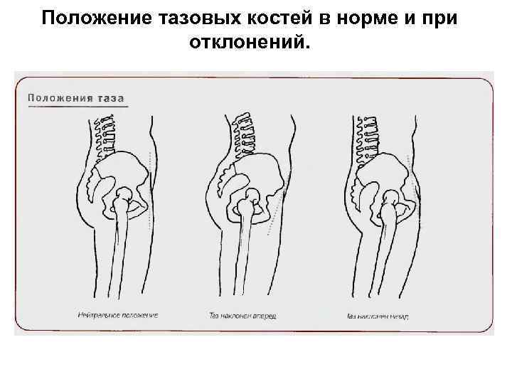 Положение тазовых костей в норме и при отклонений. 