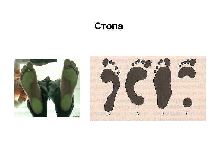 Стопа 