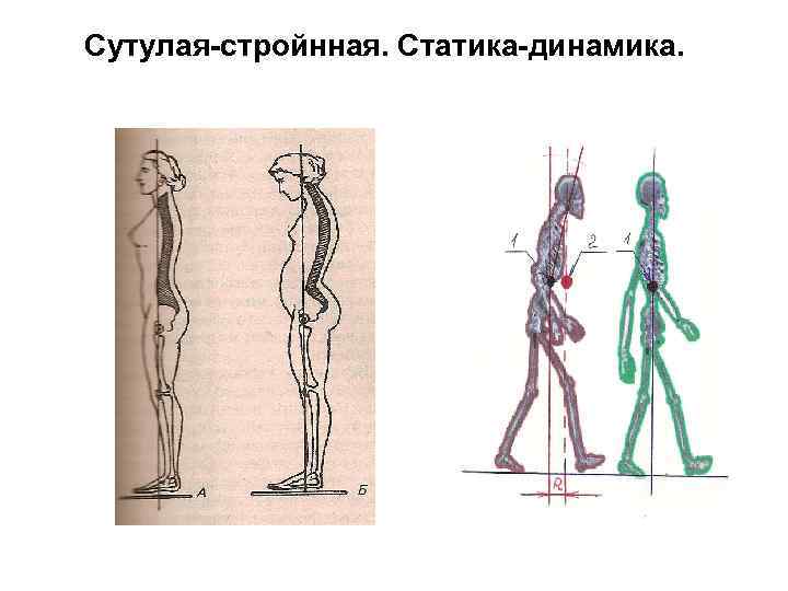 Сутулая-стройнная. Статика-динамика. 