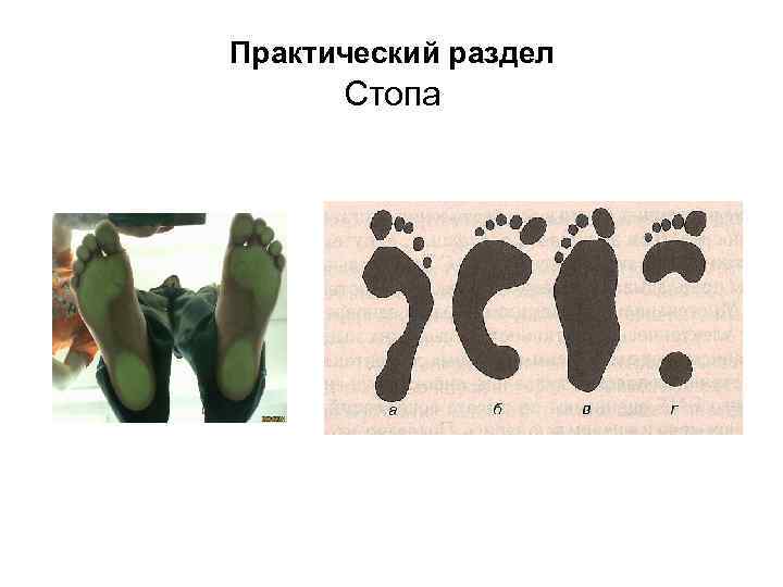 Практический раздел Стопа 