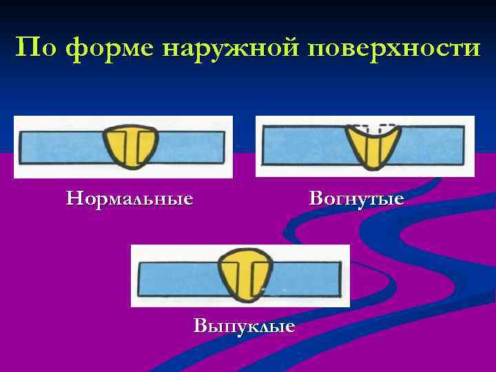 По форме наружной поверхности Нормальные Выпуклые Вогнутые 