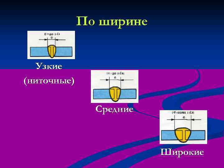 По ширине Узкие (ниточные) Средние Широкие 
