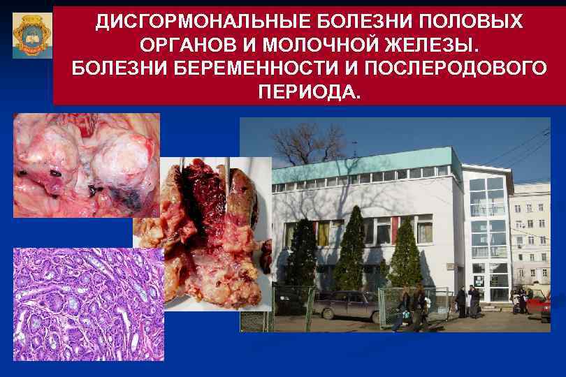 ДИСГОРМОНАЛЬНЫЕ БОЛЕЗНИ ПОЛОВЫХ ОРГАНОВ И МОЛОЧНОЙ ЖЕЛЕЗЫ. БОЛЕЗНИ БЕРЕМЕННОСТИ И ПОСЛЕРОДОВОГО ПЕРИОДА. 