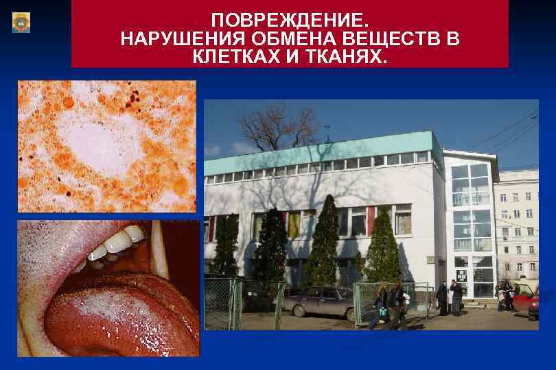 ПОВРЕЖДЕНИЕ. НАРУШЕНИЯ ОБМЕНА ВЕЩЕСТВ В КЛЕТКАХ И ТКАНЯХ. 