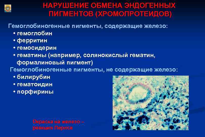 НАРУШЕНИЕ ОБМЕНА ЭНДОГЕННЫХ ПИГМЕНТОВ (ХРОМОПРОТЕИДОВ) Гемоглобиногенные пигменты, содержащие железо: • гемоглобин • ферритин •