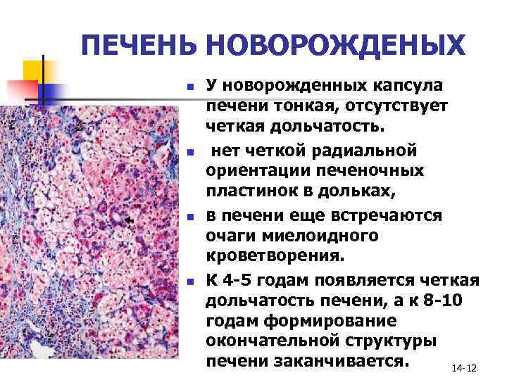 Печень гистология. Очаги экстрамедуллярного кроветворения в печени. Печень новорожденного гистология. Очаги экстрамедуллярного кроветворения микропрепарат. Печень новорожденных гистология препарат.