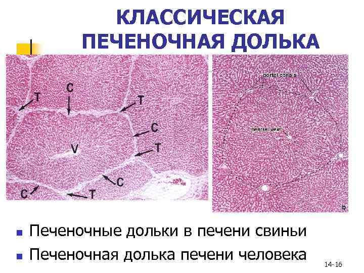 Печень гистология