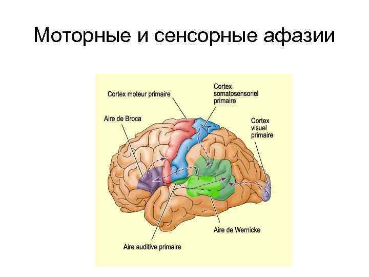 Моторные и сенсорные афазии 