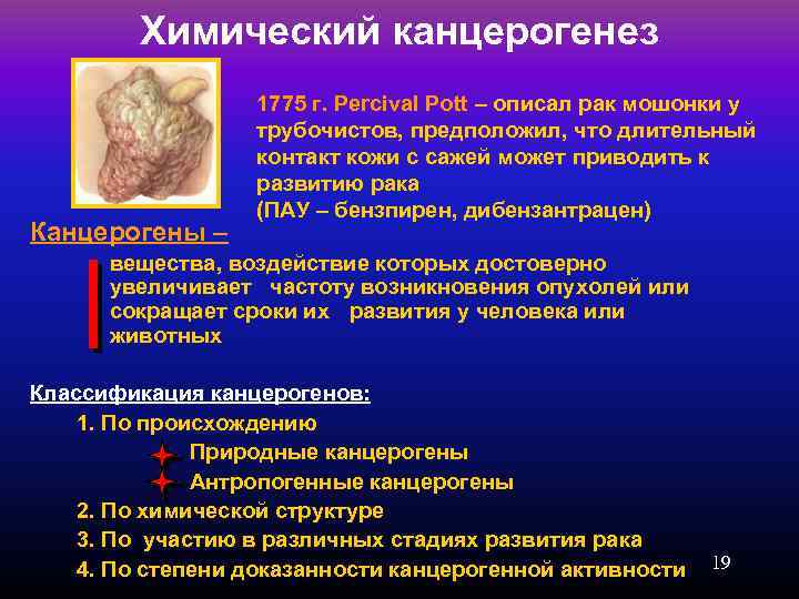 Химический канцерогенез Канцерогены – 1775 г. Percival Pott – описал рак мошонки у трубочистов,