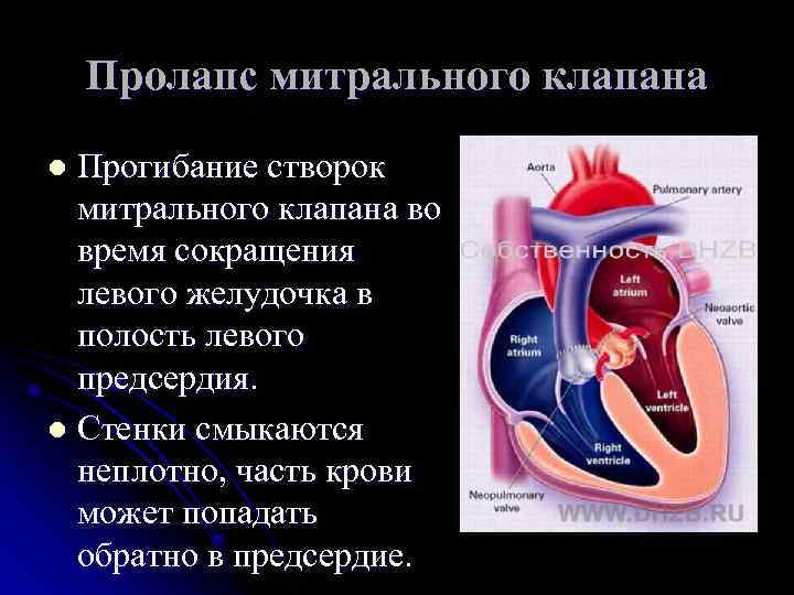 Градиент регургитации митрального клапана