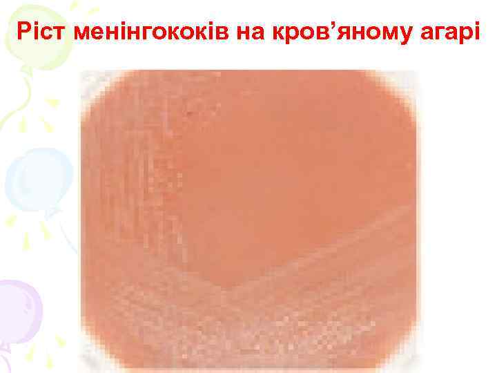 Ріст менінгококів на кров’яному агарі 