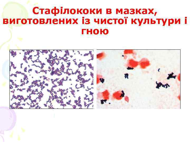 Стафілококи в мазках, виготовлених із чистої культури і гною 