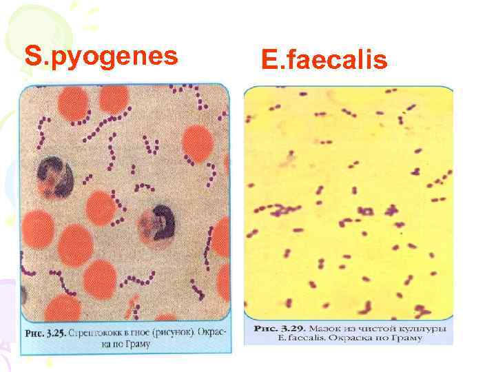 S. pyogenes E. faecalis 