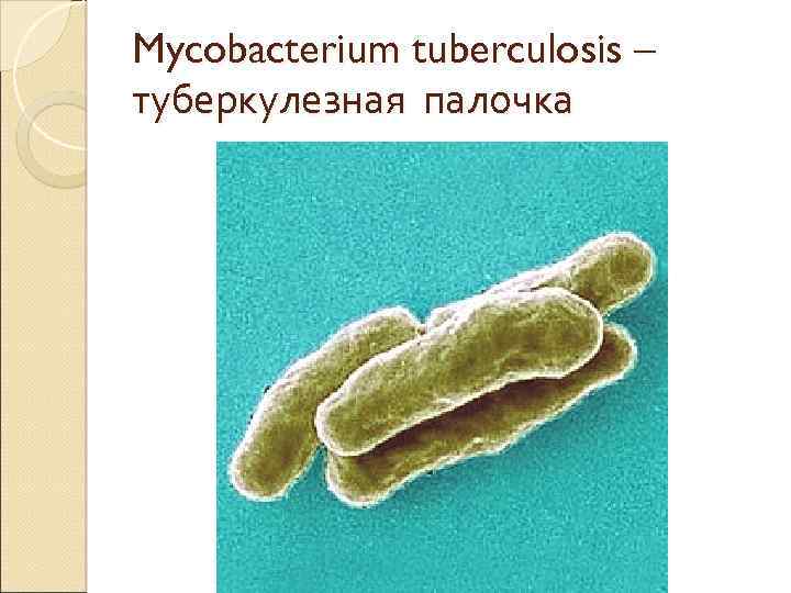 Mycobacterium tuberculosis – туберкулезная палочка 