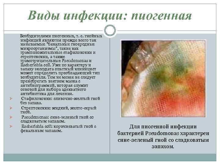 Виды инфекции: пиогенная Ø Ø Возбудителями пиогенных, т. е. гнойных инфекций являются прежде всего
