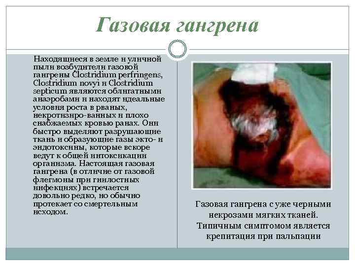 Газовая гангрена Находящиеся в земле и уличной пыли возбудители газовой гангрены Clostridium perfringens, Clostridium