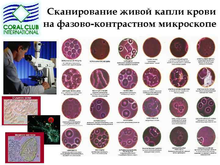 Сканирование живой капли крови на фазово-контрастном микроскопе 