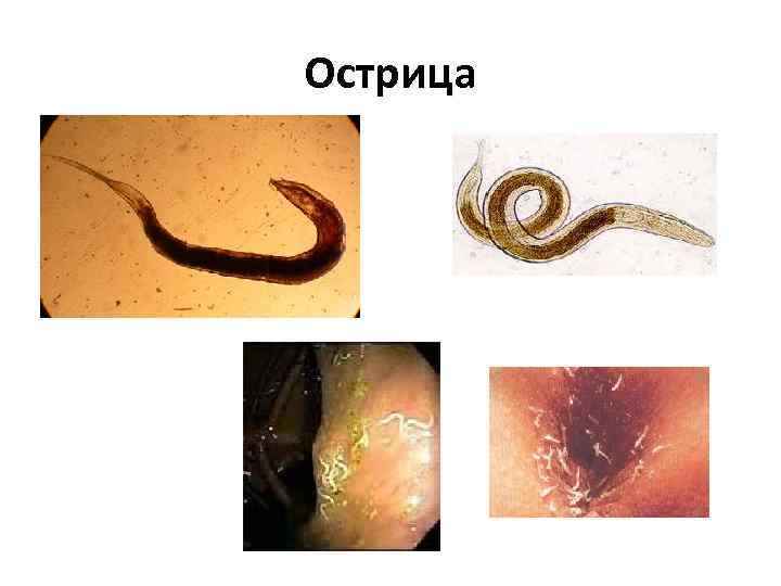 Схема лечения остриц