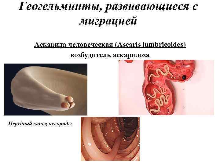 Геогельминты, развивающиеся с миграцией Аскарида человеческая (Ascaris lumbricoides) возбудитель аскаридоза Передний конец аскариды 