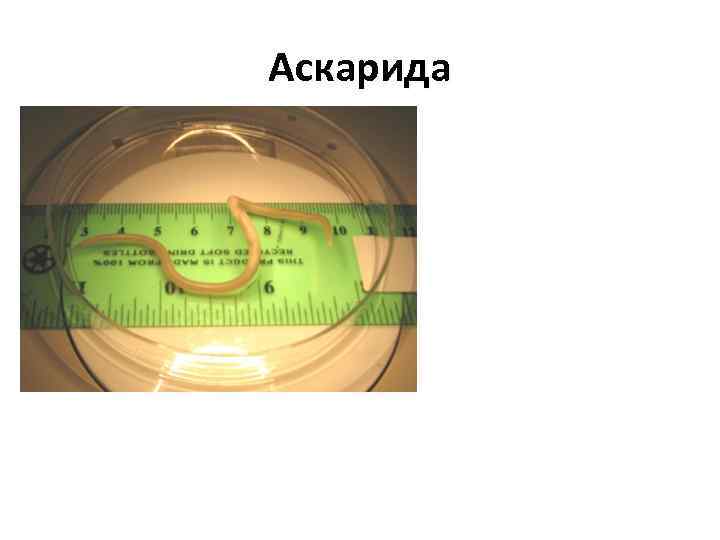 Аскарида 
