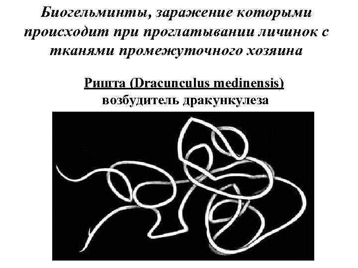 Биогельминты, заражение которыми происходит при проглатывании личинок с тканями промежуточного хозяина Ришта (Dracunculus medinensis)