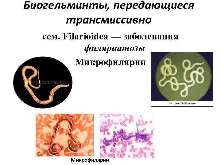 Биогельминты, передающиеся трансмиссивно сем. Filarioidea — заболевания филяриатозы Микрофилярии 