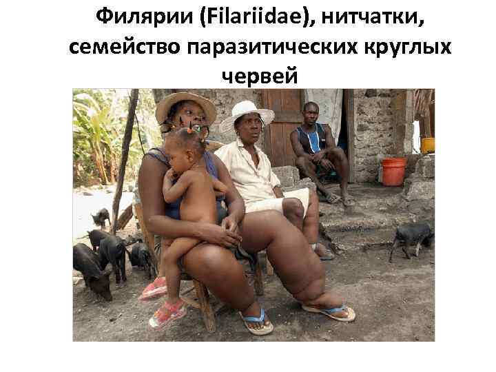 Филярии (Filariidae), нитчатки, семейство паразитических круглых червей 