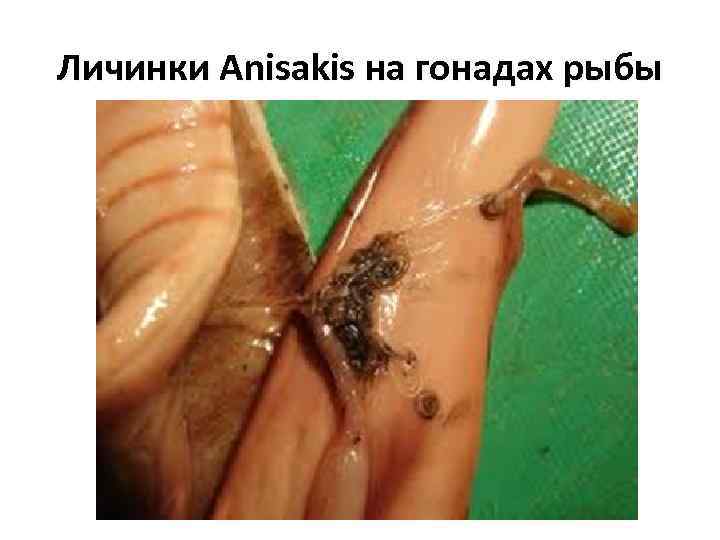 Личинки Anisakis на гонадах рыбы 