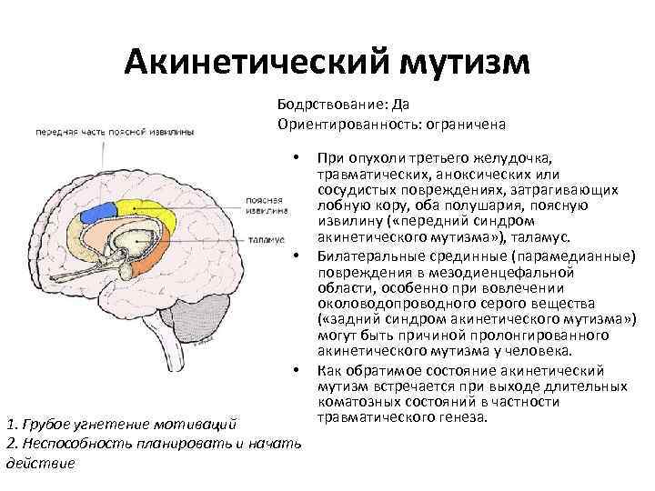 Акинетический мутизм Бодрствование: Да Ориентированность: ограничена • • • 1. Грубое угнетение мотиваций 2.