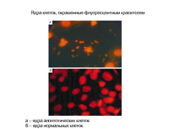Ядра клеток, окрашенные флуоресцентным красителем а – ядра апоптотических клеток б – ядра нормальных