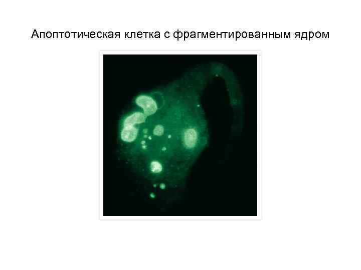 Апоптотическая клетка с фрагментированным ядром 