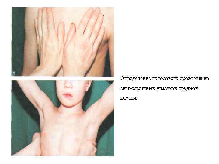 Определение голосового дрожания на симметричных участках грудной клетки. 
