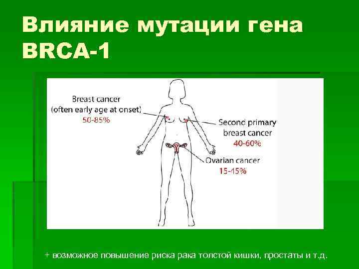 Влияние мутации гена BRCA-1 + возможное повышение риска рака толстой кишки, простаты и т.