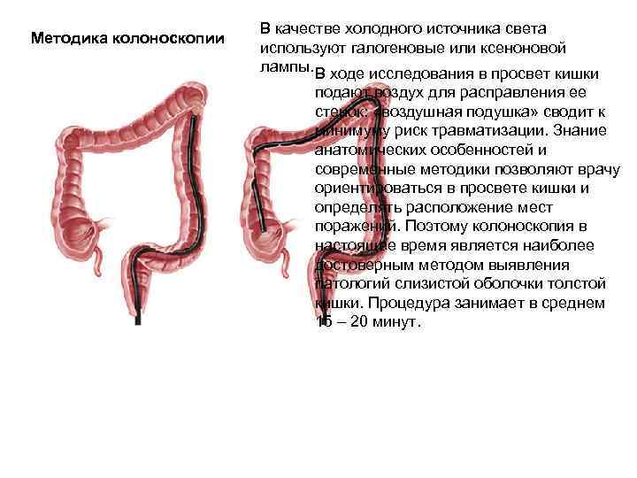 Методика колоноскопии В качестве холодного источника света используют галогеновые или ксеноновой лампы. В ходе