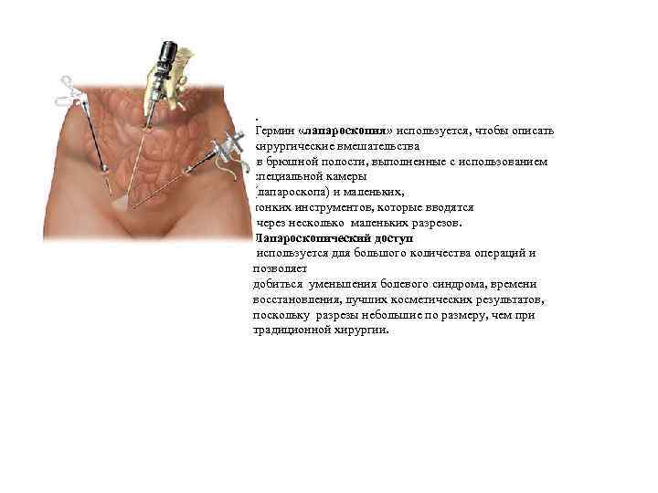 Термин «лапароскопия» используется, чтобы описать хирургические вмешательства в брюшной полости, выполненные с использованием специальной