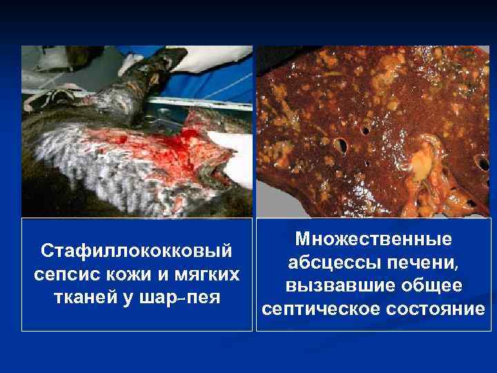 Стафиллококковый сепсис кожи и мягких тканей у шар-пея Множественные абсцессы печени, вызвавшие общее септическое