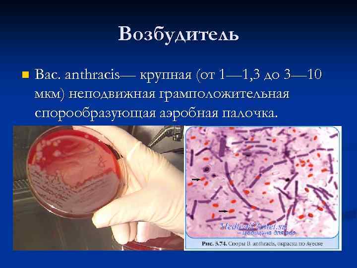Возбудитель n Вас. anthracis— крупная (от 1— 1, 3 до 3— 10 мкм) неподвижная