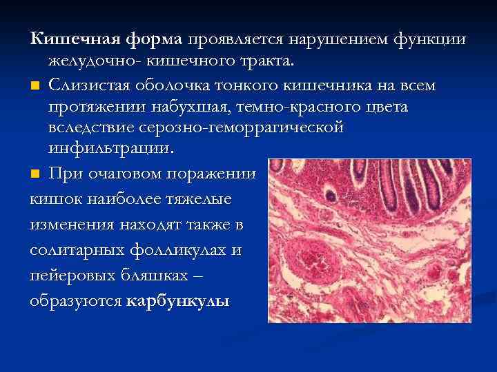 Кишечная форма проявляется нарушением функции желудочно- кишечного тракта. n Слизистая оболочка тонкого кишечника на