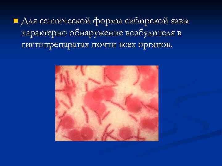 n Для септической формы сибирской язвы характерно обнаружение возбудителя в гистопрепаратах почти всех органов.