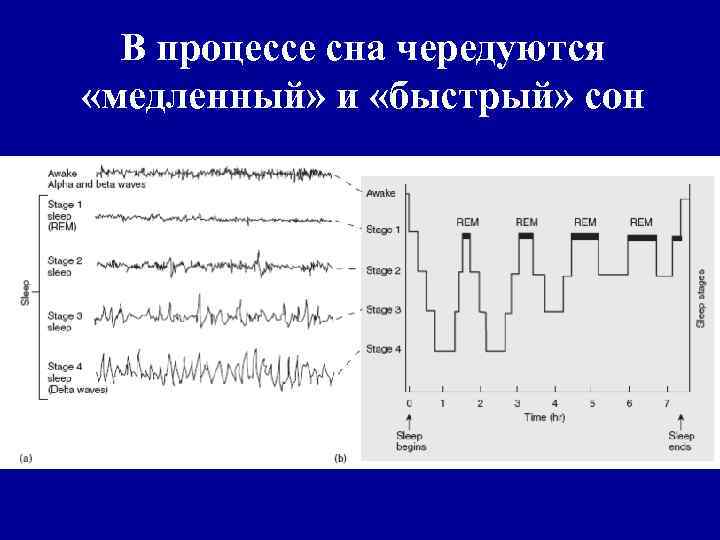 В процессе сна чередуются «медленный» и «быстрый» сон 