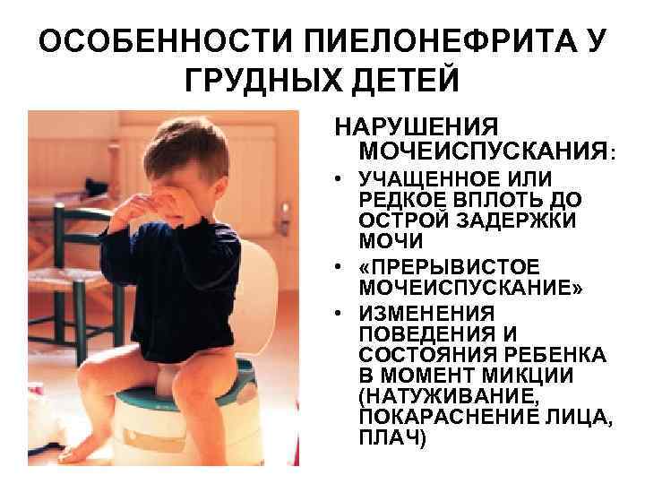 ОСОБЕННОСТИ ПИЕЛОНЕФРИТА У ГРУДНЫХ ДЕТЕЙ НАРУШЕНИЯ МОЧЕИСПУСКАНИЯ: • УЧАЩЕННОЕ ИЛИ РЕДКОЕ ВПЛОТЬ ДО ОСТРОЙ